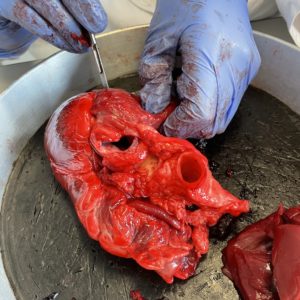 Aorta und Pulmonalarterie